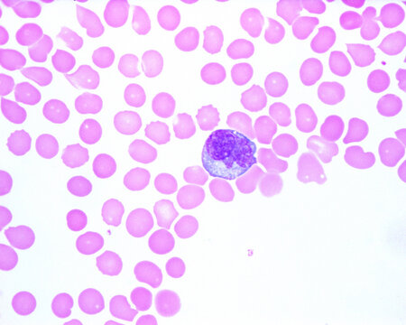 Human blood smear. Monocyte