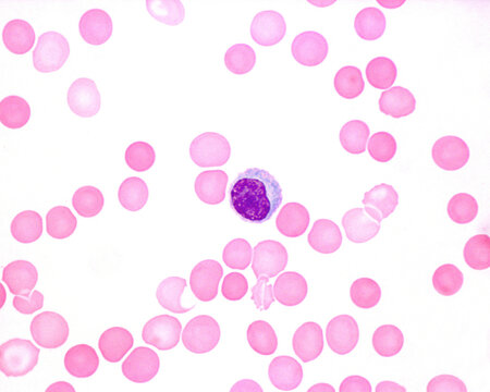 Human Blood Smear. Monocyte