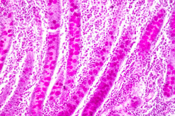 
Tissue of Small intestine (Duodenum) and Vermiform appendix  Human under the microscope in Lab.
