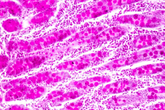
Tissue of Small intestine (Duodenum) and Vermiform appendix  Human under the microscope in Lab.
