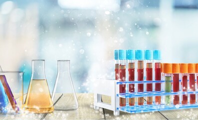 Science glass flask with extraction glassware set with blue chemical molecular structure in...