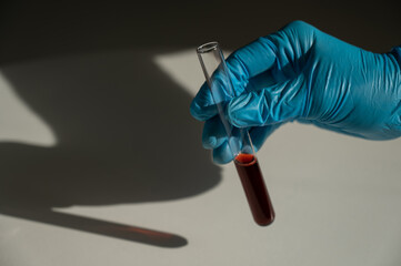 Female hand in a glove holds a test tube with blood. 