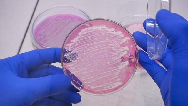 The scientist holds an open petri dish in his hands and makes an analysis of human bacteria colonies, close-up. The human microbiota is studied by microbiologists.