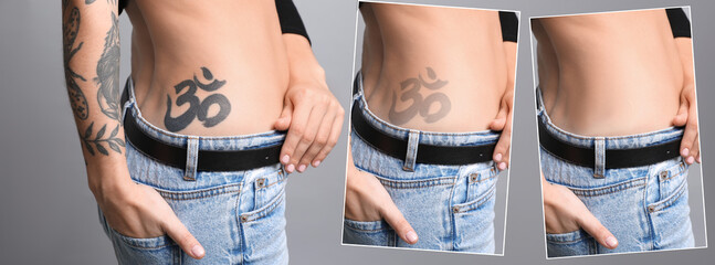 Woman before and after laser tattoo removal procedures on grey background, closeup. Collage with...