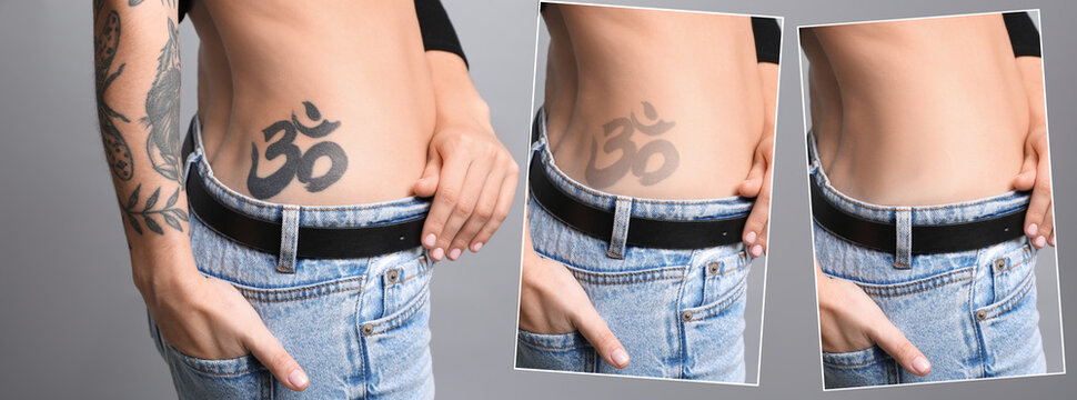 Woman before and after laser tattoo removal procedures on grey background, closeup. Collage with photos, banner design