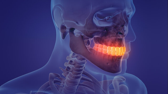 Animation of a painful teeth	