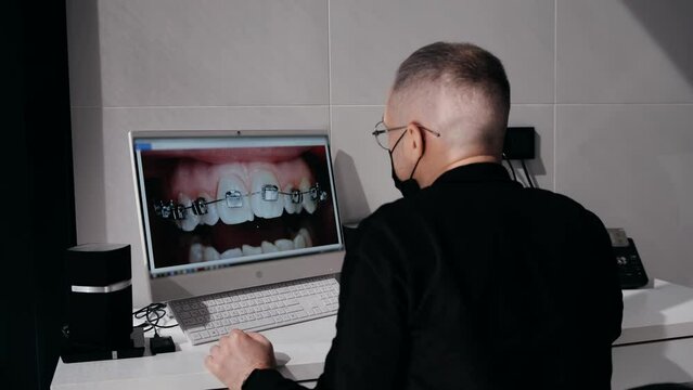 Doctor orthodontist looks at the computer monitor, studying the picture of the patient's teeth. Installation of braces