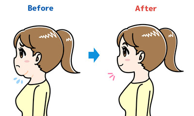 二重アゴの女性のビフォーアフターのイラスト