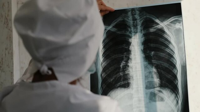 Professional female doctor checking a patient's x-ray