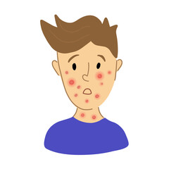 Male suffering from new virus Monkeypox. kid face sick with chickenpox pox virus infection. flat character portrait. Red rash on face - symptoms of smallpox chickempox, monkeypox