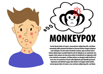 Monkeypox inphographic banner design. Male suffering from new virus Monkeypox. Monkeypox virus alert danger icon sign. flat character portrait with ed rash on face - symptoms of smallpox.