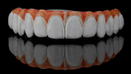 Dental prosthesis of the upper jaw from zircon with colored gums on black glass with reflection