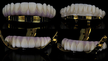 excellent dental photo collage with dentures and a golden bar, four photos on a black background