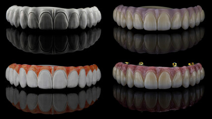 collage of their four stages of creating a prosthesis from zircon to finished prosthesis with pink...