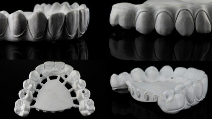 milled upper jaw prosthesis made of zircon, collage with macro photo on black glass © Dental Pro Content