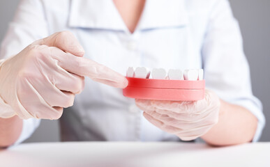 Dentist showing gingiva inflammation at jaw model with teeth. Gums irritation, redness and swelling. Periodontal diseases diagnosing and treatment. Stomatology, dental health concept. photo
