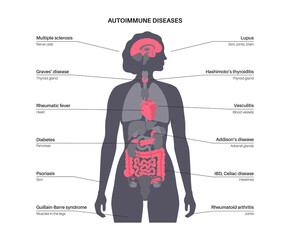 Autoimmune disorders diseases