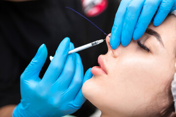 Cosmetic procedure for non-surgical rhinoplasty. The beautician inserts cosmetic threads into the...