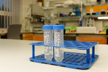 Two tubes with primary antibodies for biochemical assays
