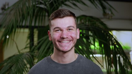 Close-up of a young man with pimples on his face. The guy laughs. Problematic skin