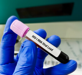 Blood sample for HIV-1 RNA viral load test.