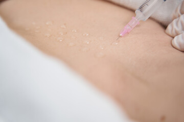 Doctor cosmetologist doing injection into client abdomen