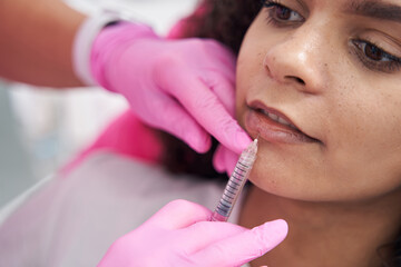Lip contouring procedure performed on the face of young patient