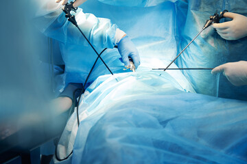 Doctors using laparoscopic camera while performins surgery