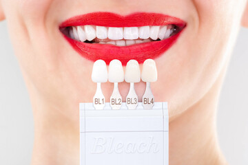 Perfect white smile red lips with shade guide bleach color tooth dental whitening, bleaching,...
