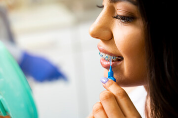 Closeup shot of beautiful young woman doing oral hygiene of dental braces with interdental brush 