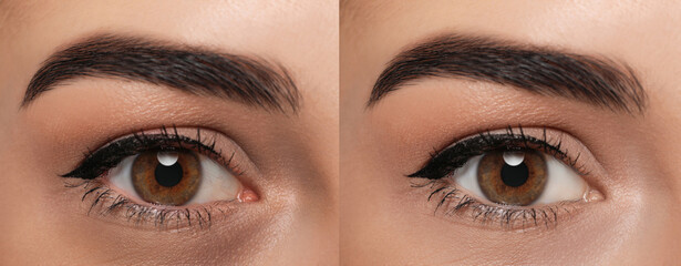 Collage with photos of tired woman with dark circle under eye and after rest, closeup. Banner design