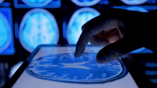 Doctor looking on tablet x-ray 