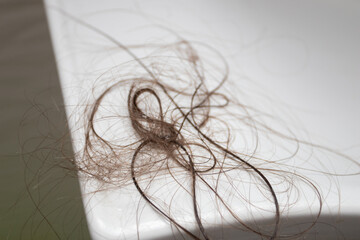 Loss hair on the bathroom sink. Alopecia