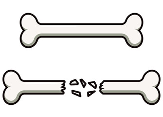 Bone. Skeleton. Healthy bone. Crossed bones.