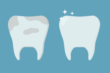 Healthy clean tooth and tooth with plaque. Template for stomatology or dentistry. Dental care Concept