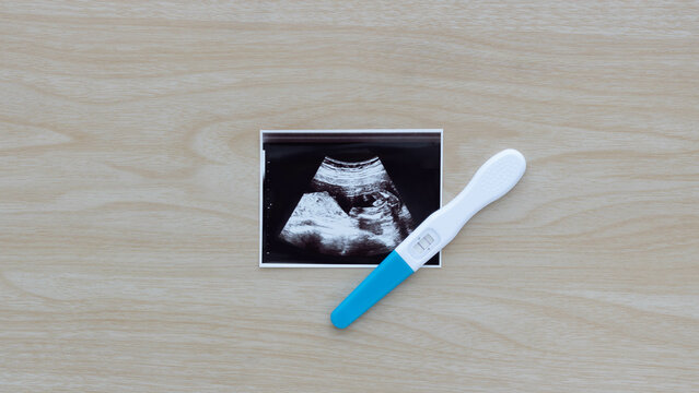 Pregnancy test showing a positive result and ultrasound picture of baby isolated on wooden background. Result of ultrasound picture, ultrasonography for pregnancy. Pregnancy care concept.