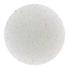 Bacteria cell finding with microscope.