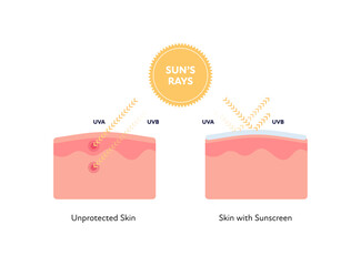 Uv rays and visible light healthcare infographic. Vector flat people illustration. UVA, UVB arrow penetarate unprotected and reflect from protected skin layers. Design for uv awareness month. - obrazy, fototapety, plakaty