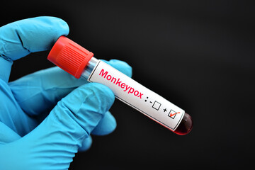 Fototapeta premium Blood sample tube positive with Monkeypox virus, new epidemic disease in 2022