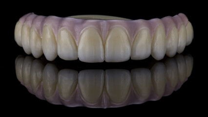 dental prosthesis of the upper jaw from zircon with pink gum on black glass with creative reflection