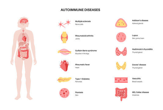 Autoimmune disorders diseases