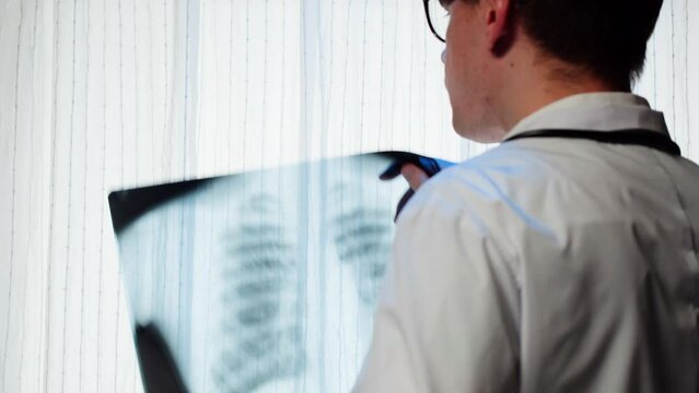 Healthcare and medicine. Doctor examining lungs x-ray close-up. Male nurse looking at ribs roentgen, human chest, checkup