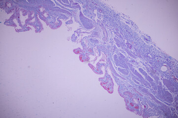Columnar epithelium of human gall bladder under the microscope in Lab.