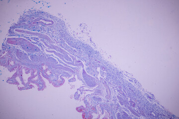 Columnar epithelium of human gall bladder under the microscope in Lab.