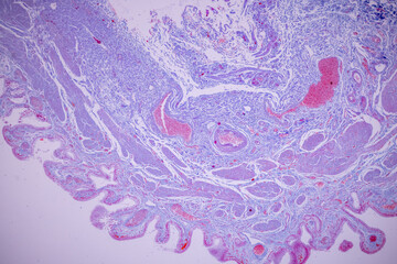 Columnar epithelium of human gall bladder under the microscope in Lab.