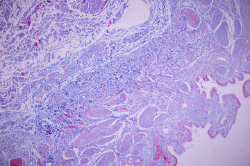 Columnar epithelium of human gall bladder under the microscope in Lab.