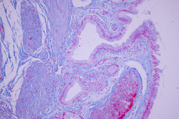 Columnar epithelium of human gall bladder under the microscope in Lab.