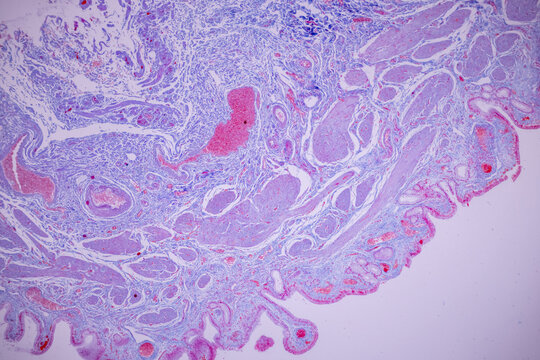 Columnar epithelium of human gall bladder under the microscope in Lab.