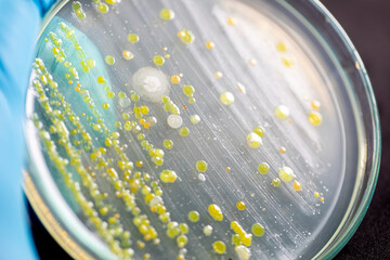 Backgrounds of Characteristics and Different shaped Colony of Bacteria and Mold growing on agar plates from Soil samples for education in Microbiology laboratory.