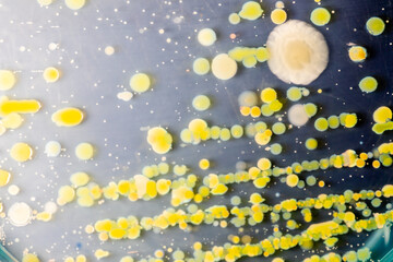 Backgrounds of Characteristics and Different shaped Colony of Bacteria and Mold growing on agar plates from Soil samples for education in Microbiology laboratory.